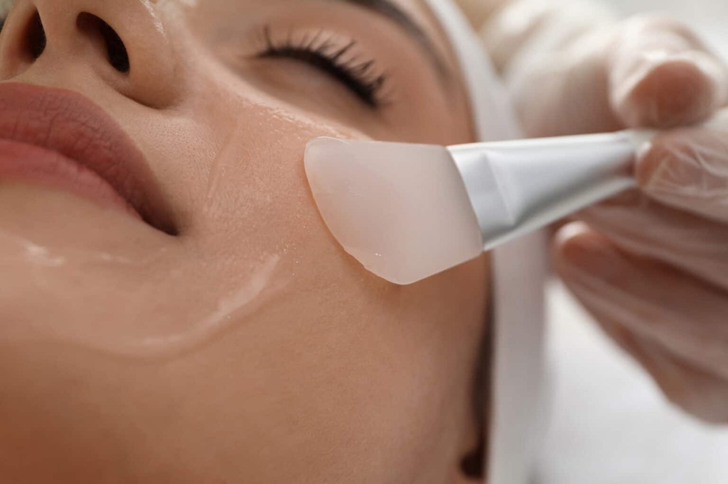 Chemical Peel in Islamabad