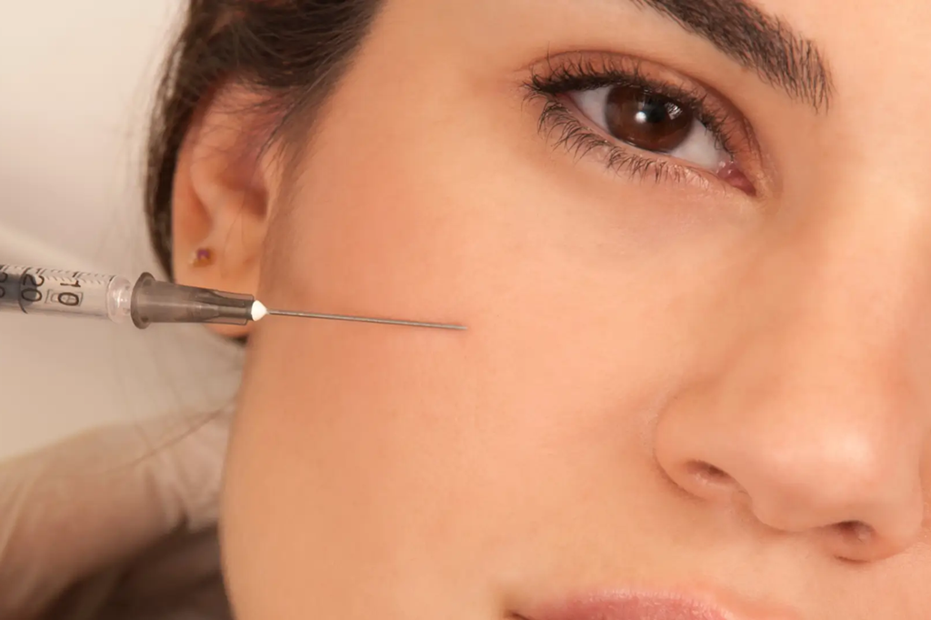 Dermal Fillers in islamabad