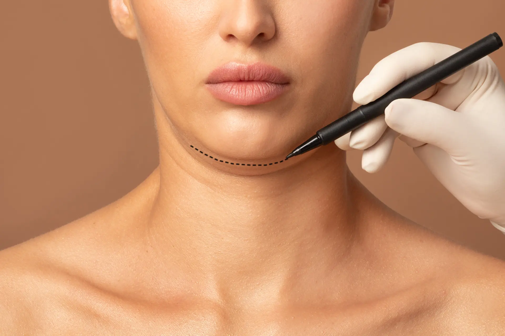 double chin removal in Islamabad