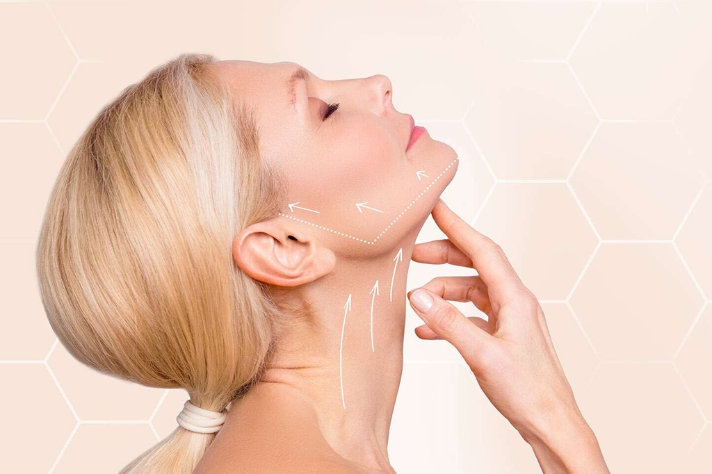 Necklift Treatment in Islamabad