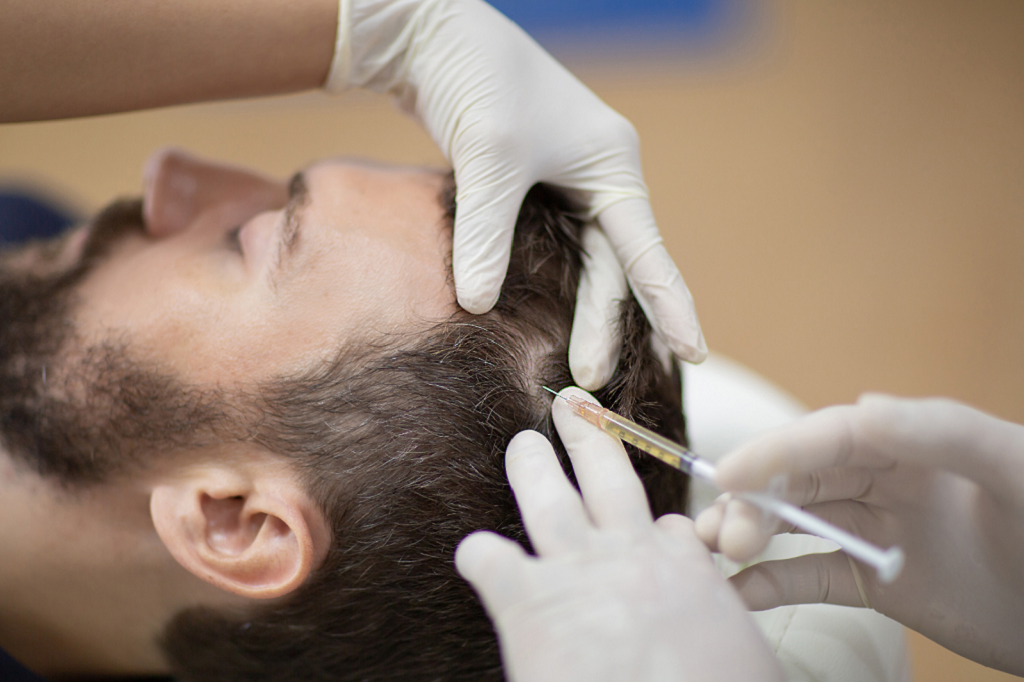 PRP for Hair in Islamabad - Dr. Afsheen Bilal