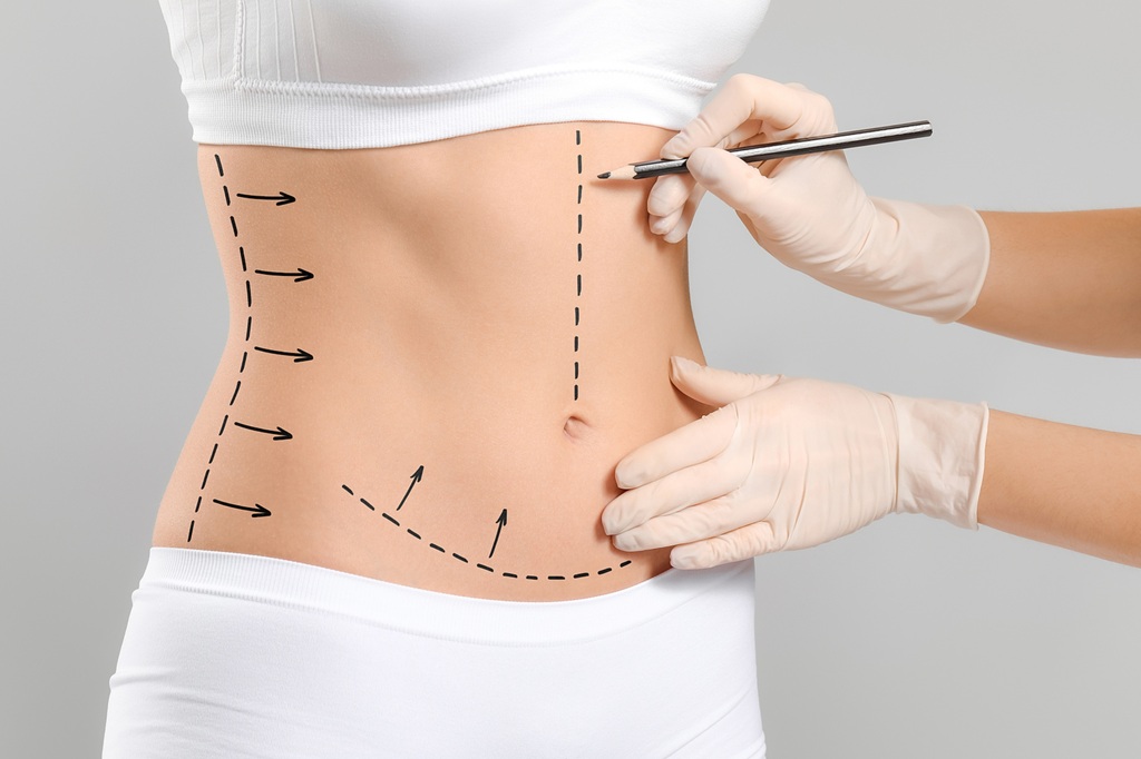 Tummy Tuck in Islamabad