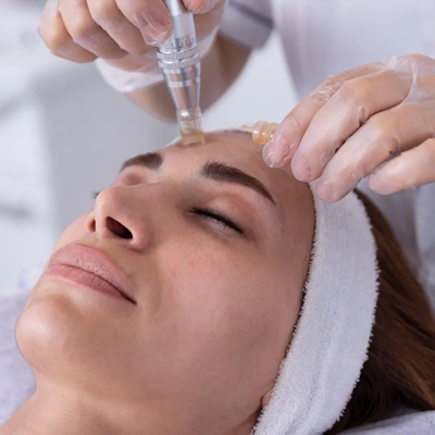 How Long Do Microneedling Results Last?
