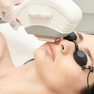Is Laser Hair Removal Permanent?