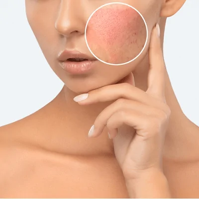 Can Skin Whitening Cause Allergies