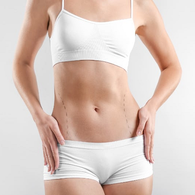 How Long Does It Take To Recover From Liposuction