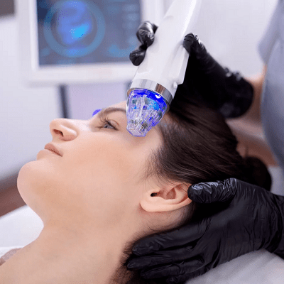 Exosome Therapy for Skin & Hair Regeneration