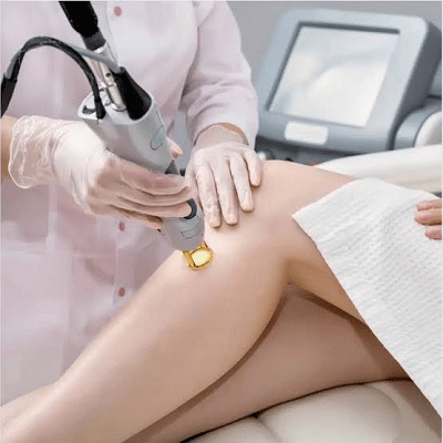 Safe Laser Hair Removal for All Skin Tones