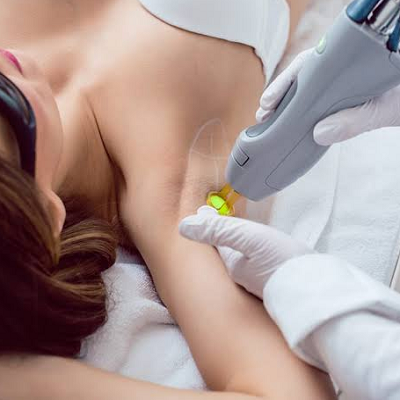Can Laser Hair Removal Help with Ingrown Hairs